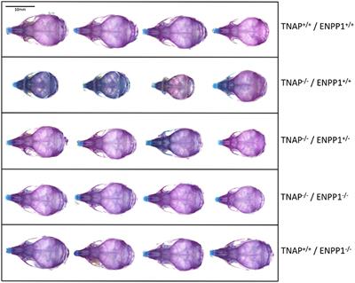 Deletion of the Pyrophosphate Generating Enzyme ENPP1 Rescues Craniofacial Abnormalities in the TNAP−/− Mouse Model of Hypophosphatasia and Reveals FGF23 as a Marker of Phenotype Severity